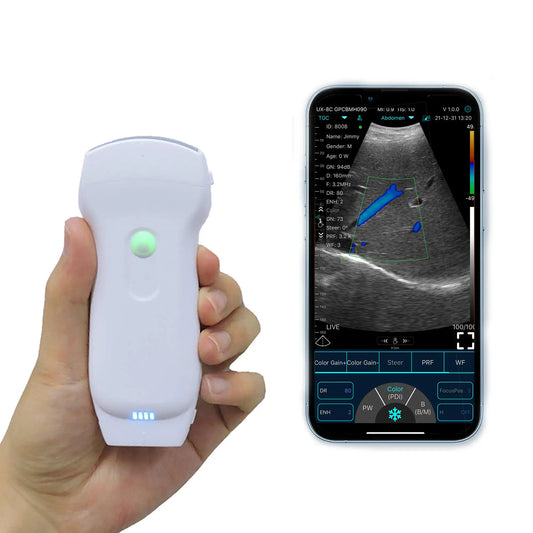 Wireless Color Doppler Ultrasound C10RL