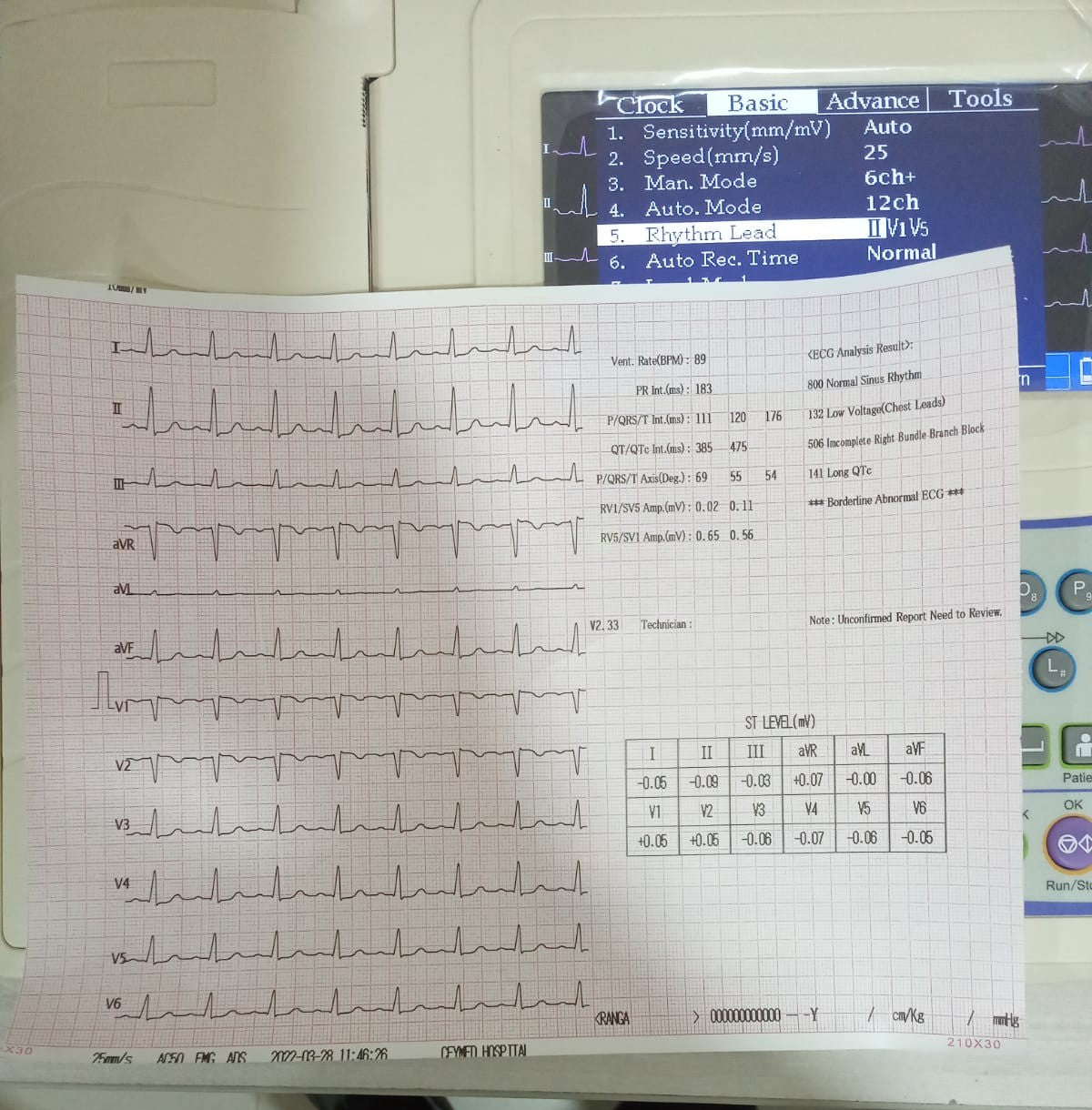 Portable ECG – 12-Lead Clinical Diagnostic System SUN-8121