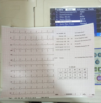 Portable ECG – 12-Lead Clinical Diagnostic System SUN-8121