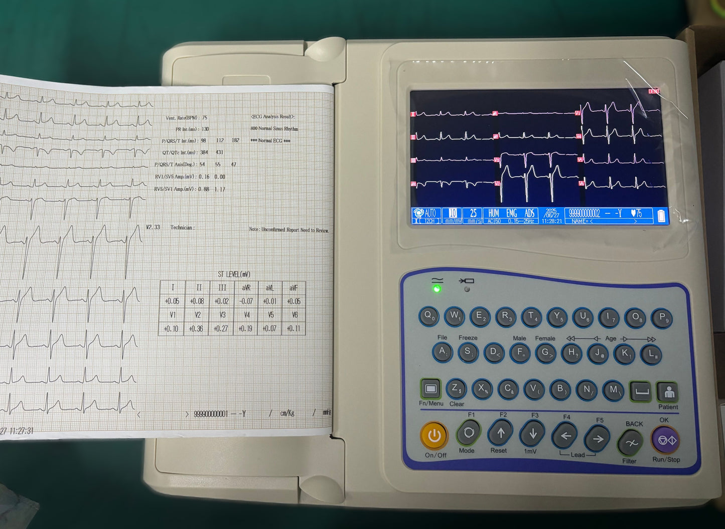 Portable ECG – 12-Lead Clinical Diagnostic System SUN-8121