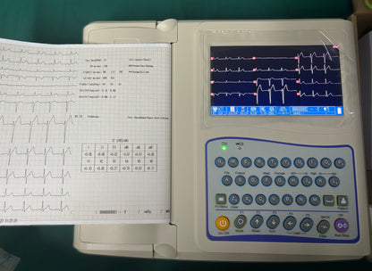Portable ECG – 12-Lead Clinical Diagnostic System SUN-8121