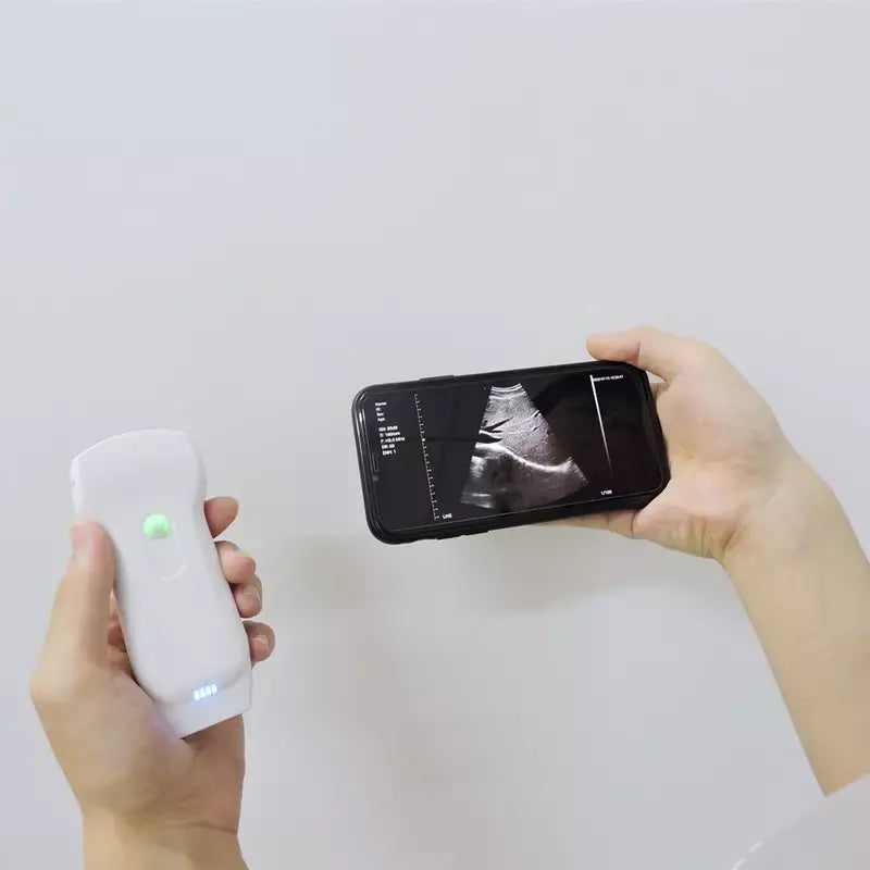 Wireless Color Doppler Ultrasound C10RL